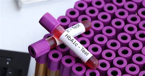 Thyroid Health in Women: Hormone Levels & Key Symptoms