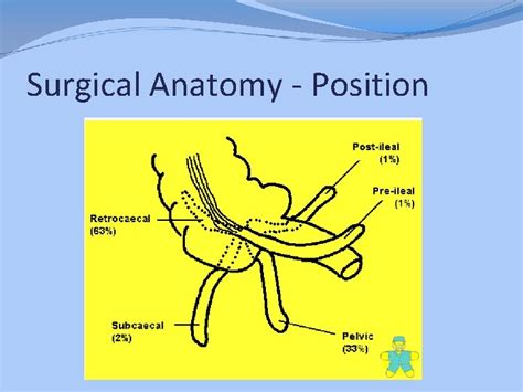 Image result for Appendicitis Position