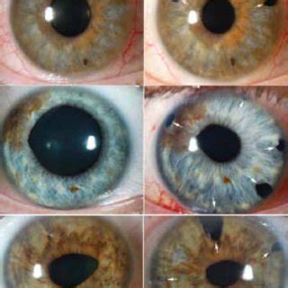 Image result for Iris Flower Python Project