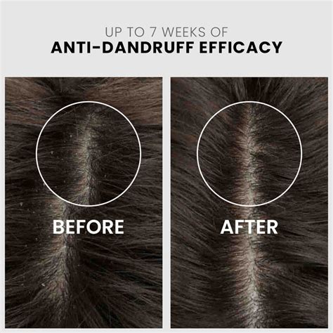 Top Hair Care Products Online in India | Keraology