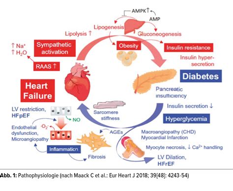 Herzinsuffizienz und Diabetes - Endokrinologie & Diabetologie ...
