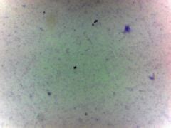 Image result for Bacteria Microscope Slides