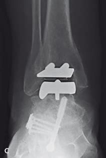 Hardware Monitor Driver 的图像结果