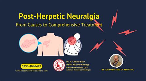 Decoding Post-Herpetic Neuralgia: From Causes to Comprehensive ...