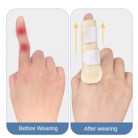 Pain Relief Trigger Adjustable Finger Fixing Splint Brace Splint ...