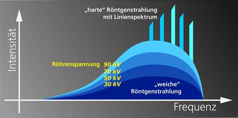 Optimale Bildqualität durch richtige Strahlendosierung