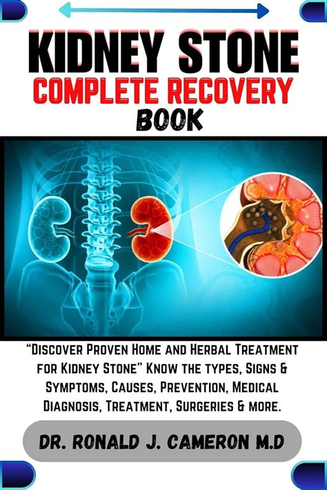 KIDNEY STONE COMPLETE RECOVERY BOOK: “Discover Proven Home and Herbal ...