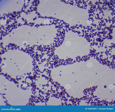 Staphylococcus Aureus Under Microscope 的图像结果