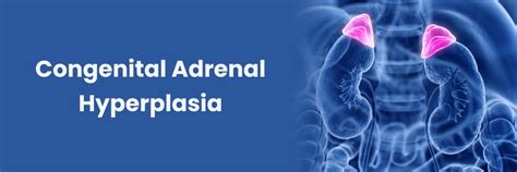 Congenital Adrenal Hyperplasia: All You Need To Know