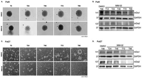 The Cytoskeleton Effectors Rho-Kinase (ROCK) and Mammalian Diaphanous ...
