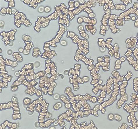 What other jobs can you get with MLS degree? : r/medlabprofessionals