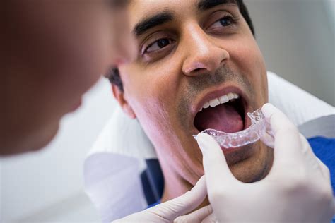 Damon Braces vs Traditional Braces: Key Differences – Diamond Braces