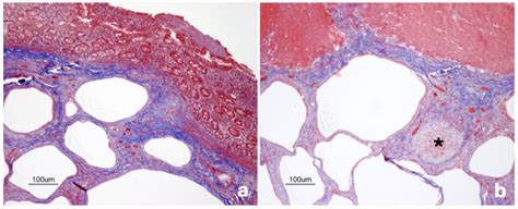 Unveiling Intestinal Emphysema in Pigs: Morphological Insights and ...