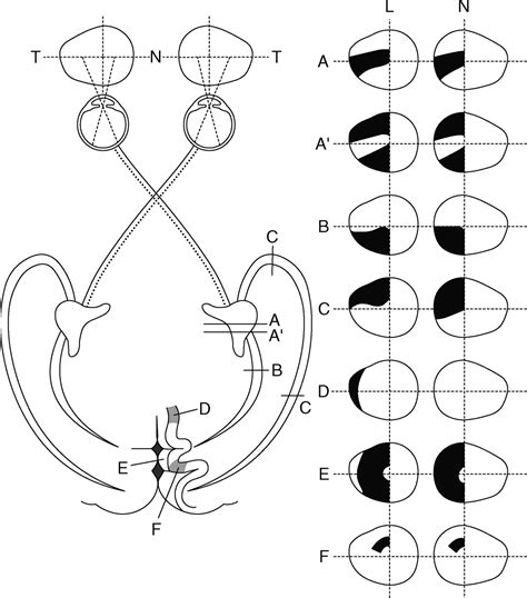Lateral Geniculate Visual Field