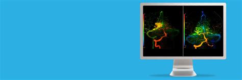 AngioViz | GE HealthCare (India)