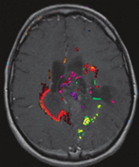 Image result for fMRI Python