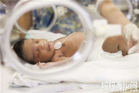 早产儿什么时候可以出院有标准 切记听从医嘱 - 妈妈育儿网