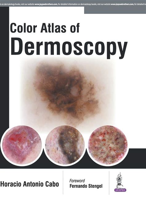 Color Atlas Of Dermoscopy - All India Book House