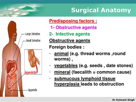 Image result for Appendicitis Position