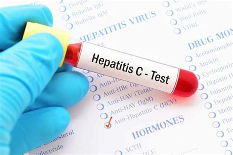 Hep C Test 的图像结果