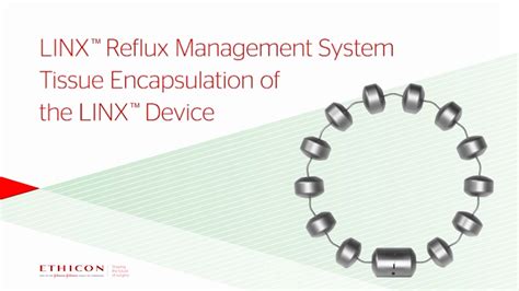 Image result for Linx Reflux Management System