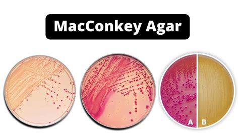 Macconkey Agar File:Klebsiella Growth On MacConkey Agar.jpg
