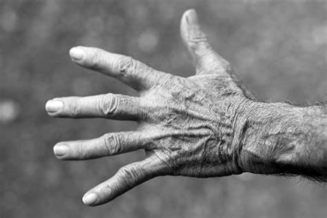 Why Are My Veins So Visible? - The Ultimate Vein Guide