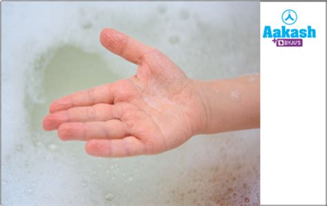 Plasmolysis in Biology: Definition, Types and Importance of Plasmolysis ...