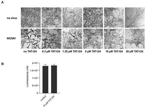 Selective Inhibition of Murine Cytomegalovirus Viral Gene Expression by ...
