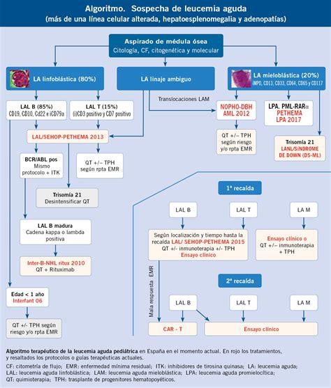 Medula Ossea Leucemia Linfoblastica Aguda