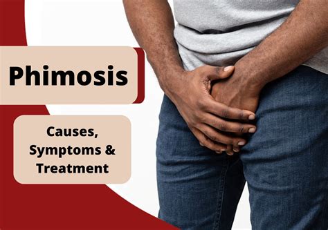 Phimosis: Causes, Symptoms & Treatment | UroLife Clinic