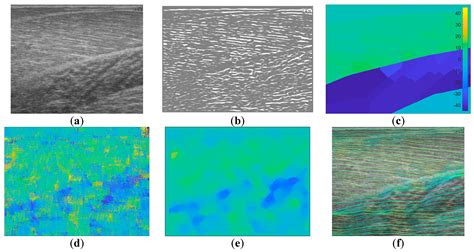 Estimating Full Regional Skeletal Muscle Fibre Orientation from B-Mode ...