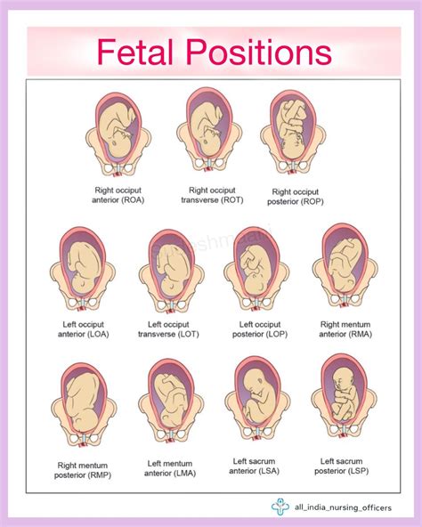 The Medical Mind on Instagram: "Fetal positions obstetrics Ideal fetal ...