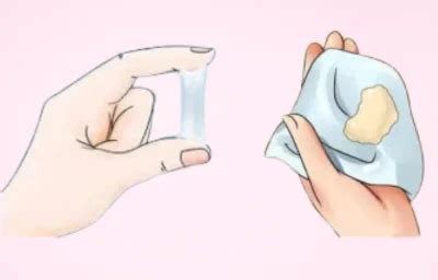 White Discharge: Types, Causes & When to See a Doctor | Pinkishe ...