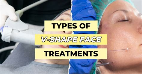 Image result for V-shape Face Exercise