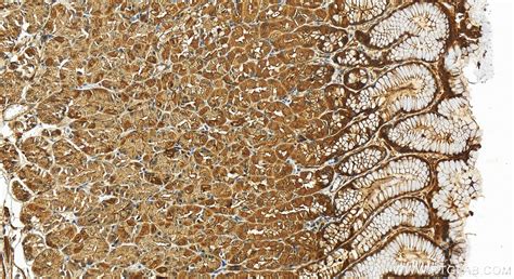 SORBS1 antibody (13854-1-AP) | Proteintech