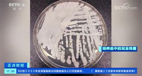 又一致命真菌在美国爆发 病例数量急剧增加_北京时间