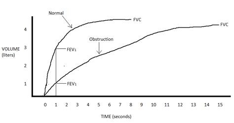 Spirometry Normal Values Chart 的图像结果