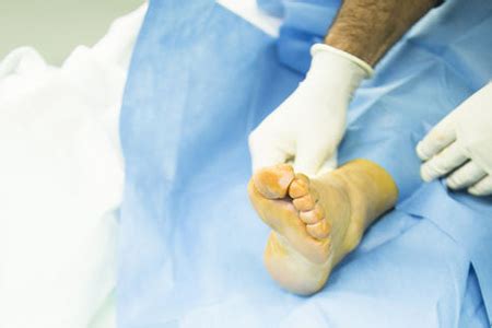 Arthroscopic ankle surgery | Orthopaedics WA