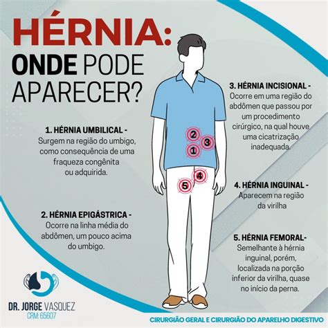 Hérnias da Parede Abdominal: Tipos, Riscos e Tratamentos