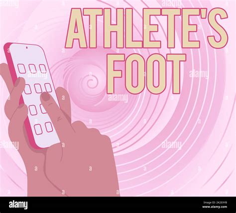 Conceptual caption Athlete S Is Foot. Concept meaning a fungus infection of the foot marked by ...