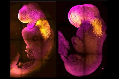 Cambridge Scientists Develop 'Synthetic' Embryo With Beating Heart And ...