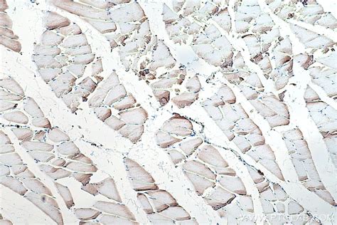 IHCeasy COX8A Ready-To-Use IHC Kit KHC0305 | Proteintech