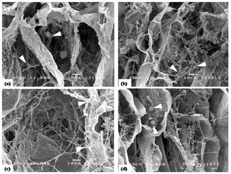 Development of Collagen/Demineralized Bone Powder Scaffolds and ...