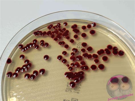 Serratia marcescens