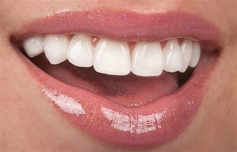 How To Reduce Gap Between Teeth Naturally At Home | ByGrandma.in