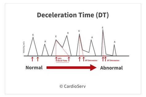 Understanding the Basics: Evaluating Diastolic Function - Cardioserv