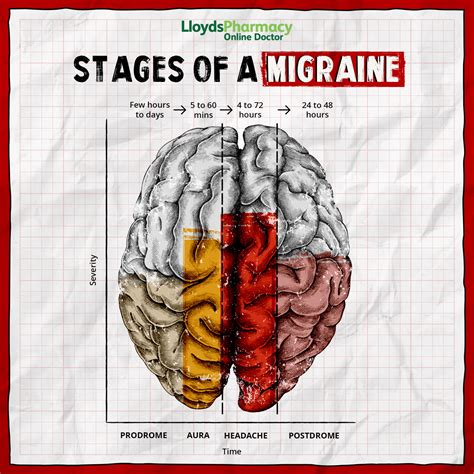 Stages of Migraines | LloydsPharmacy Online Doctor UK