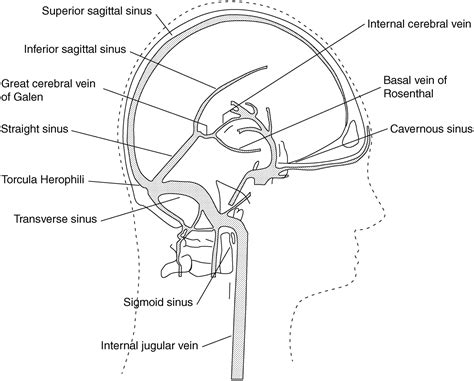 Superior Sagittal Sinus Thrombosis