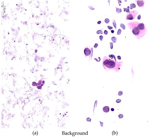 Evaluation of a Novel Fixative Solution for Liquid-Based Cytology in ...